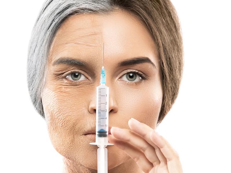 تزریق ژل یا فیلر صورت
