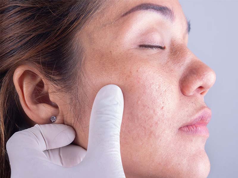 متخصص پوست و مو